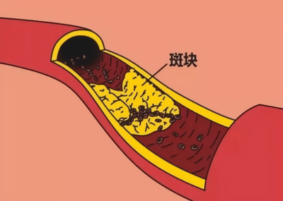 t0457d71aefcb8c0a07.png